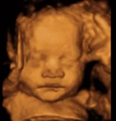 A moving 4D ultrasound GIF featuring a baby's head, highlighting the delicate features in a captivating visual.
