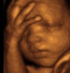 A 3D X-ray image of a baby, illustrating the delicate formation of bones and overall anatomy.